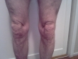 1_29-months-knees