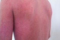 1_jake-month-2-red-back