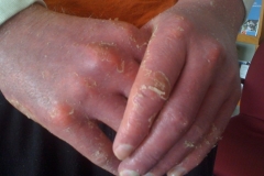 1_jake-month-3-hand