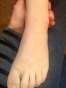 1_keegan-ft-22-months-