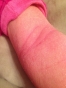 1_month-1-arm
